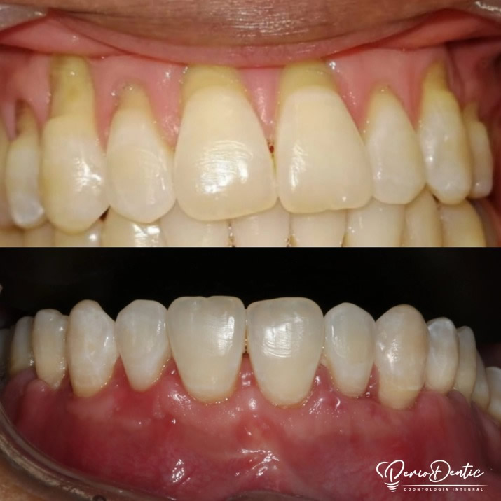 Dr. Mauricio Torres Especialista en Periodoncia y Cirugia Oral - Cali Colombia